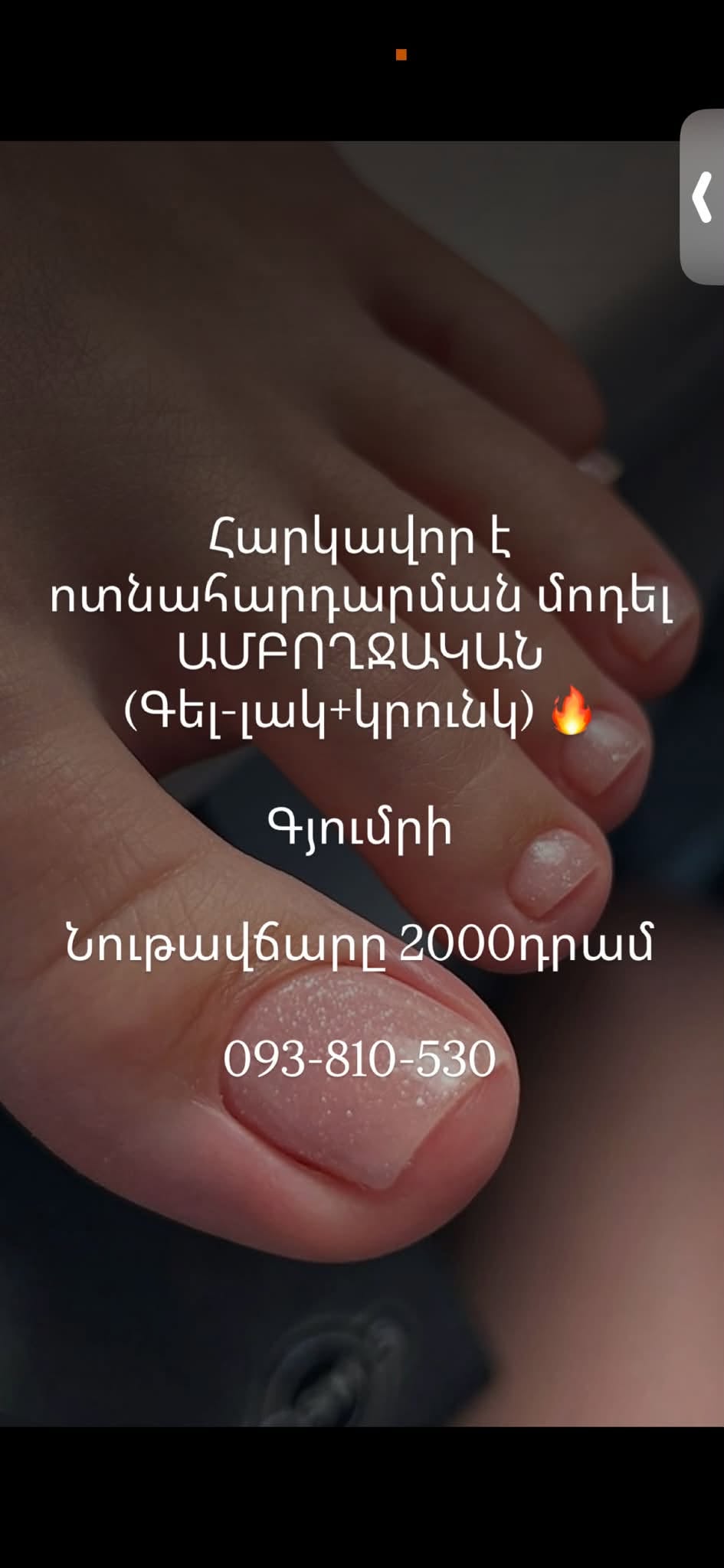 Ոտնահարդարում գել-լաքով, 2000 դրամ