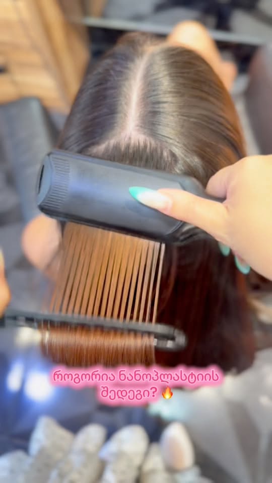 Օ՜, նանոպլաստիկան մեր մոտ շատ պահանջված պրոցեդուրա է