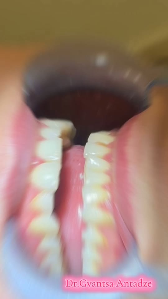 Ağız temizliği ve beyazlatma hakkında 🦷