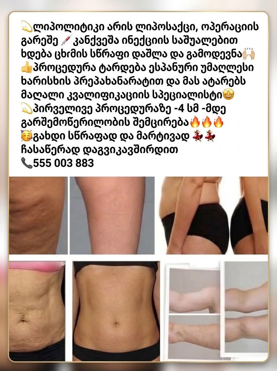 ლიპოლიზის პროცედურა ინექციით